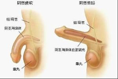 阳江治疗勃起不持久哪家医院好