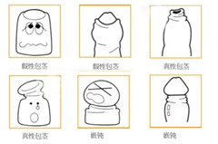 阳江做包茎手术多少钱