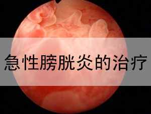 膀胱炎的危害,<a class='link_keywords' href='http://www.yjrj120.com/'>阳江仁济男科医院</a>  