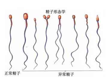 得了少精症有什么危害?